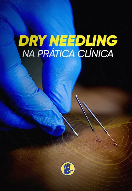 Dry Needling